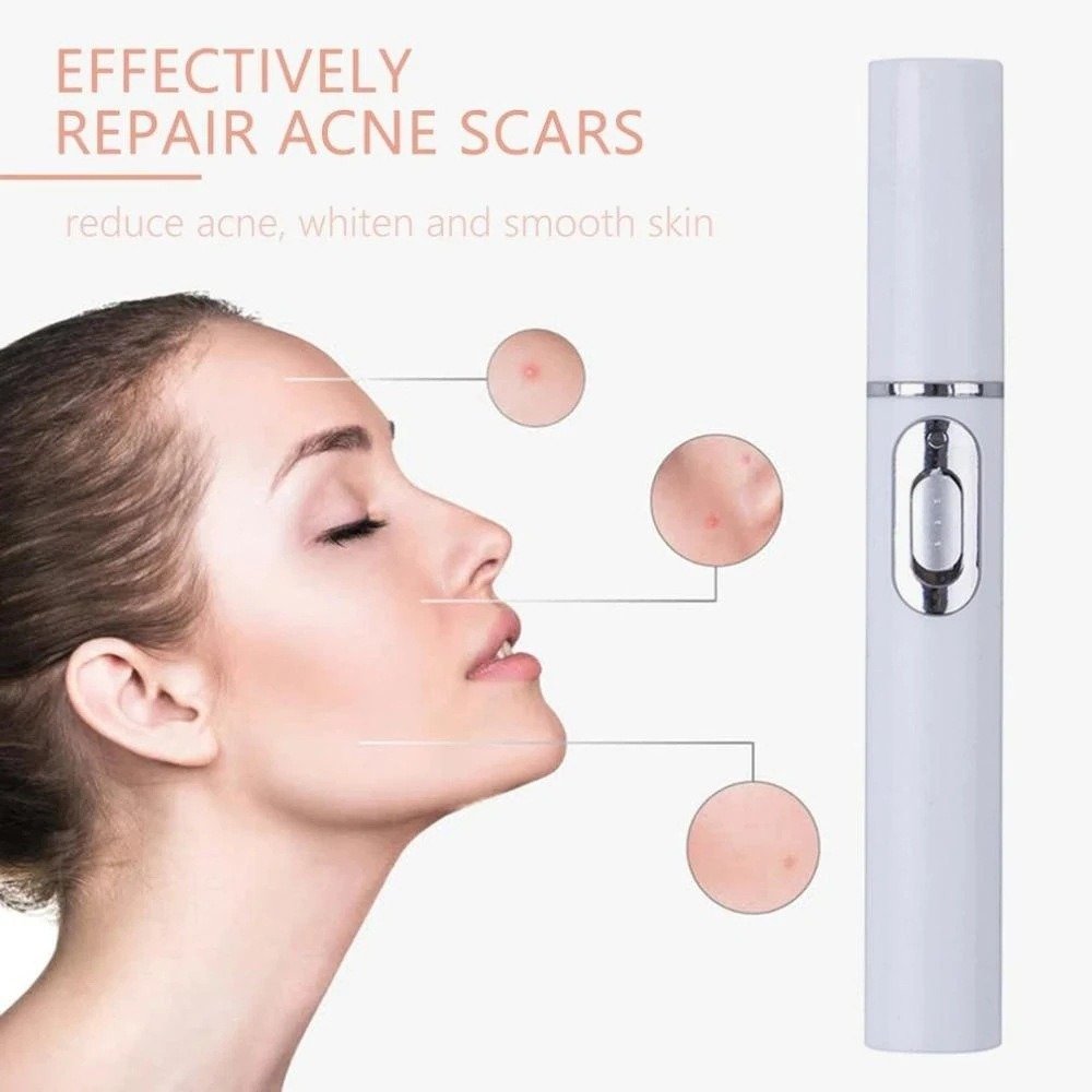 Laser Treatment Blue Light Therapy Acne Skin Care - Image 5