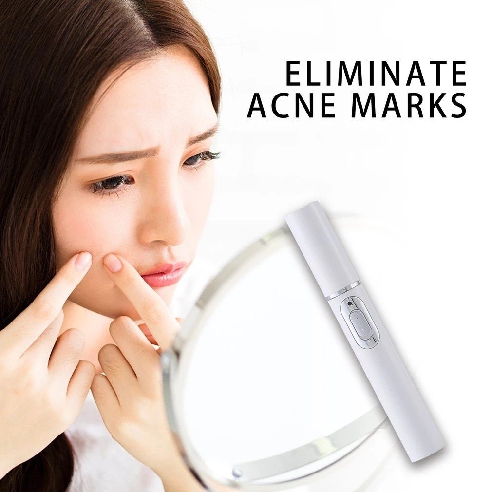 Laser Treatment Blue Light Therapy Acne Skin Care - Image 6